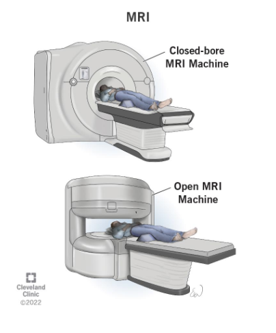 Open vs. Closed MRI Scan